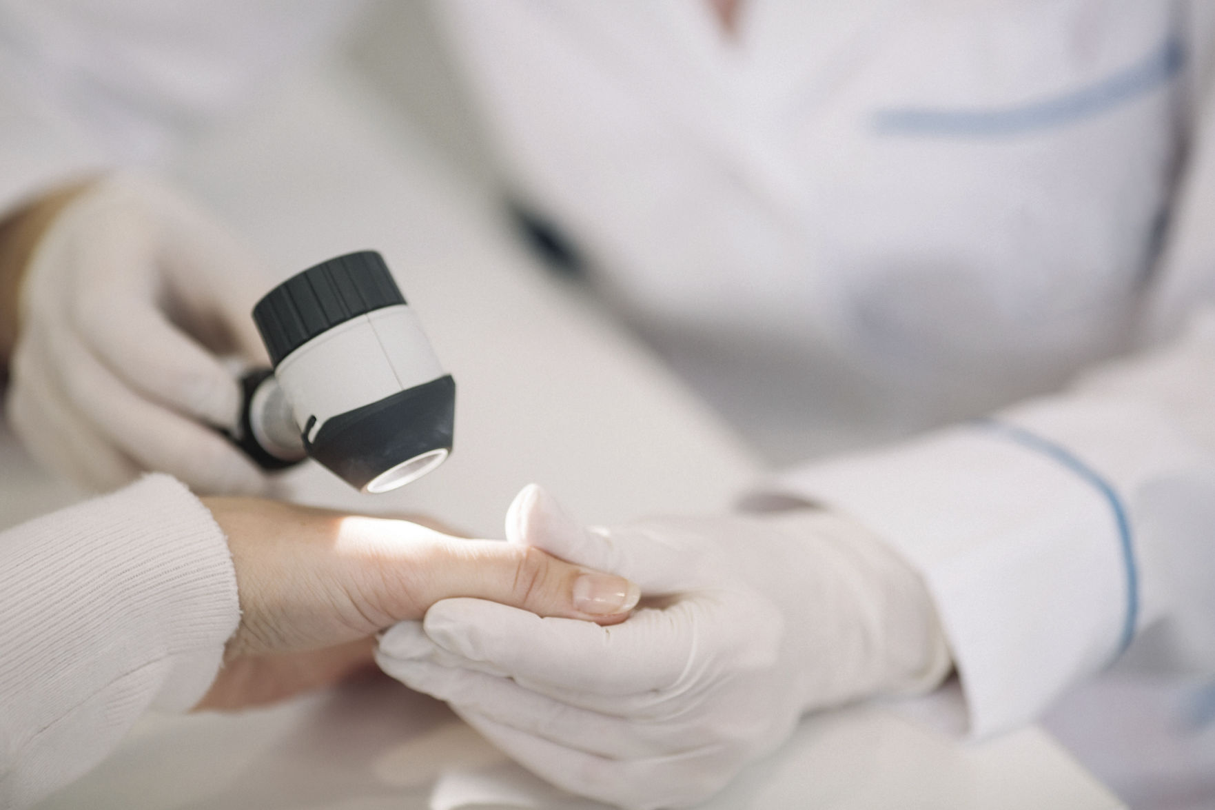 Closeup of dermatologist examining mole on hand of female patient in clinic